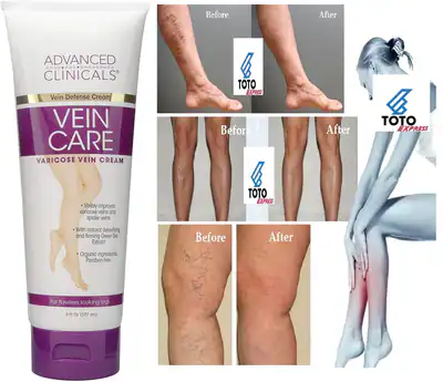 #1 Crema Para Las Varices Borra Las Venas Varicosas Elimina Verrugas y Arañitas